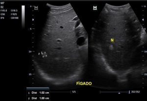 US_abdomen_superior