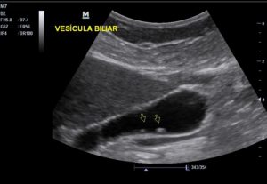 US_abdomen_total