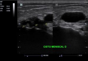 US_musculo_articulacoes